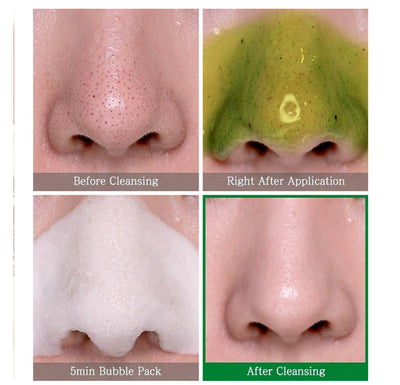 Nettoyant Bye Bye Blackhead 30 Days Miracle Green Tea Tox Bubble Some By Mi